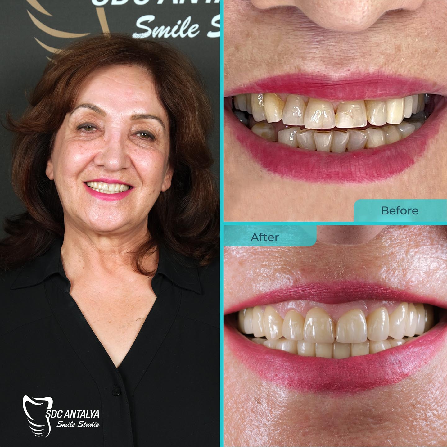 Sdc Antalya Smile Studio