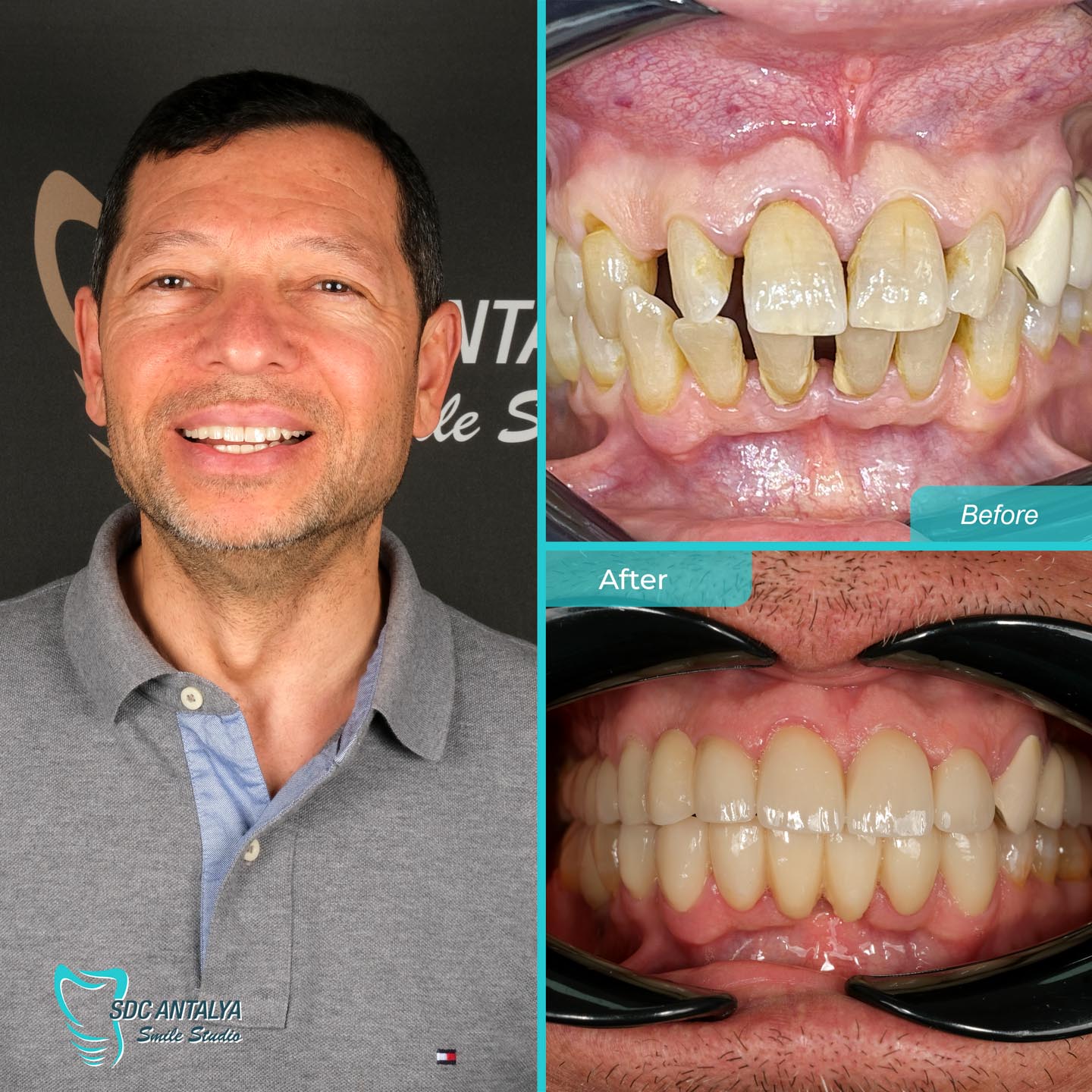 Sdc Antalya Smile Studio