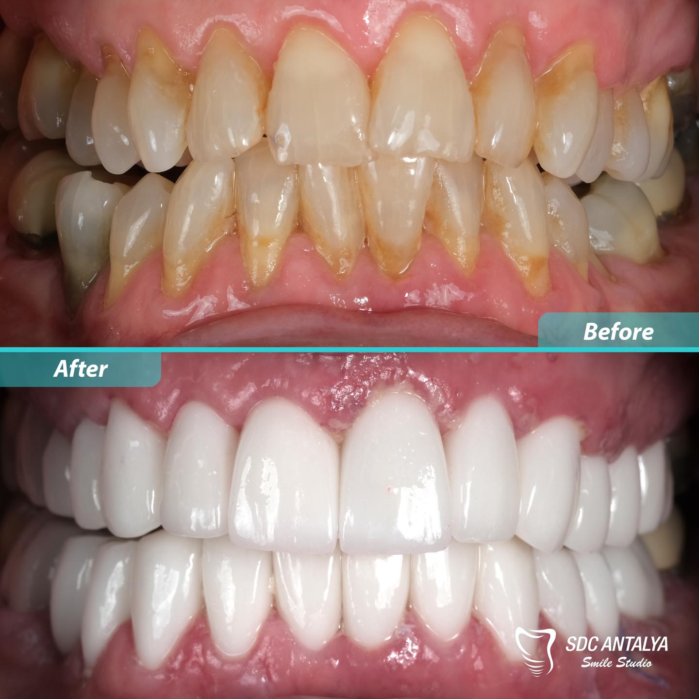 Sdc Antalya Smile Studio