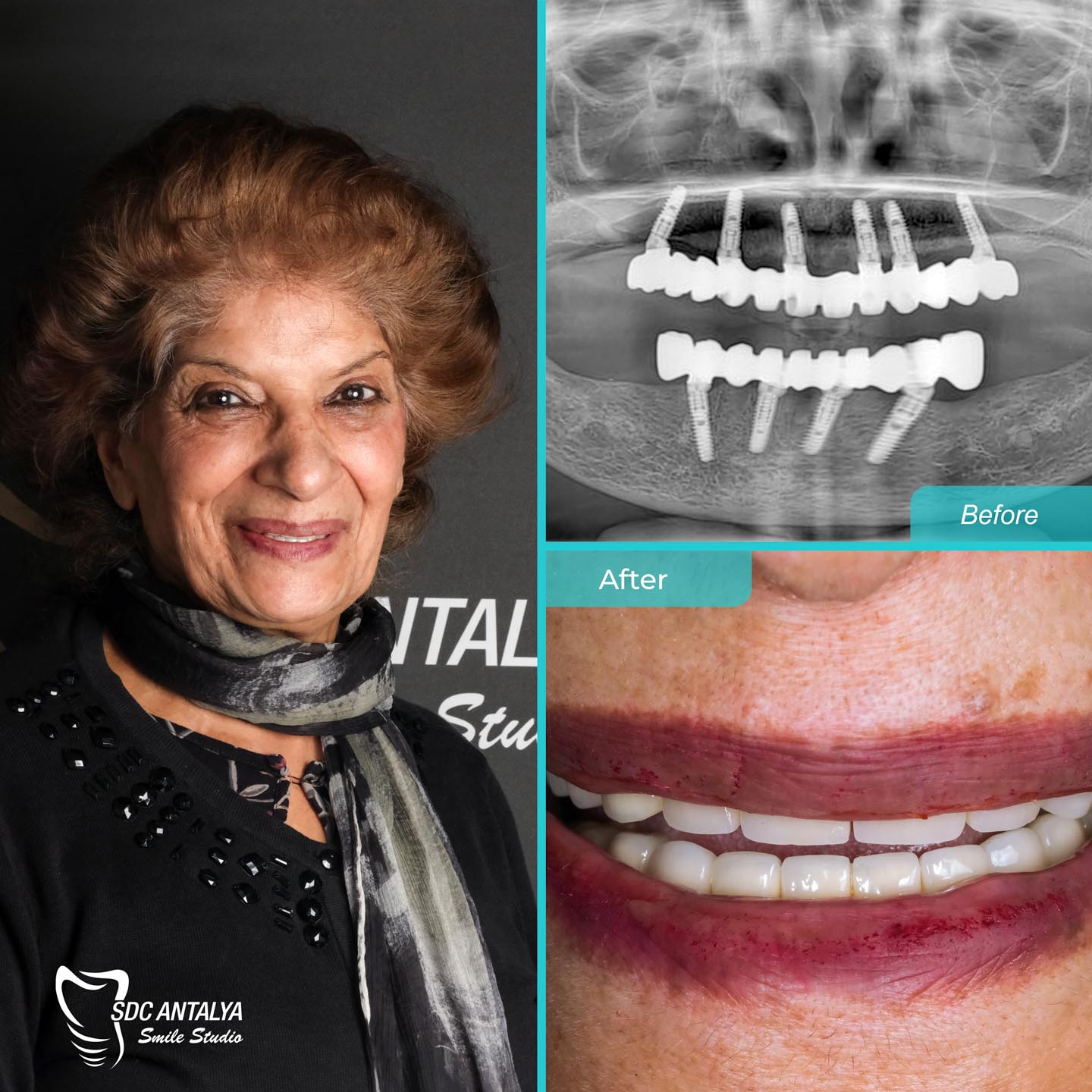 Sdc Antalya Smile Studio