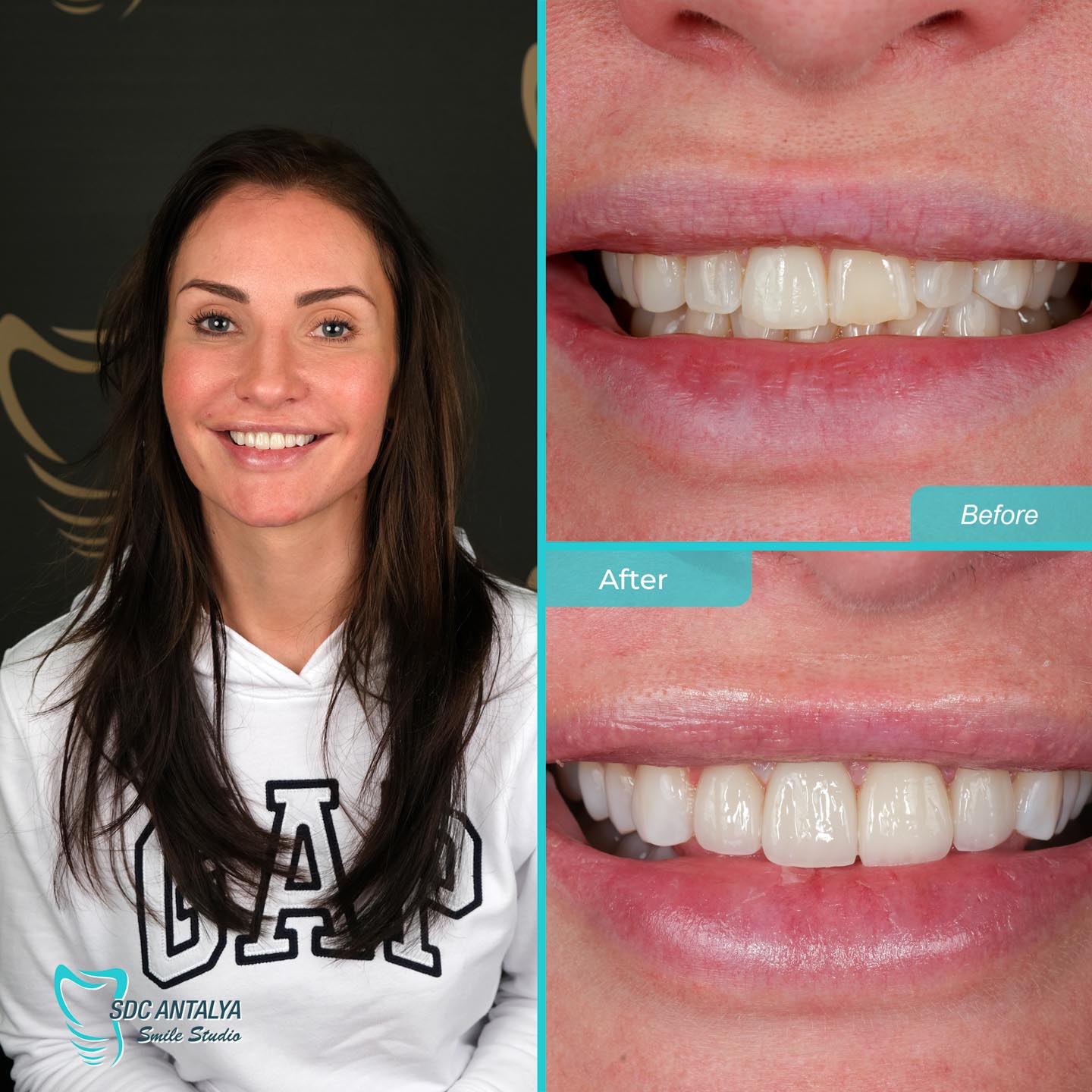 Sdc Antalya Smile Studio