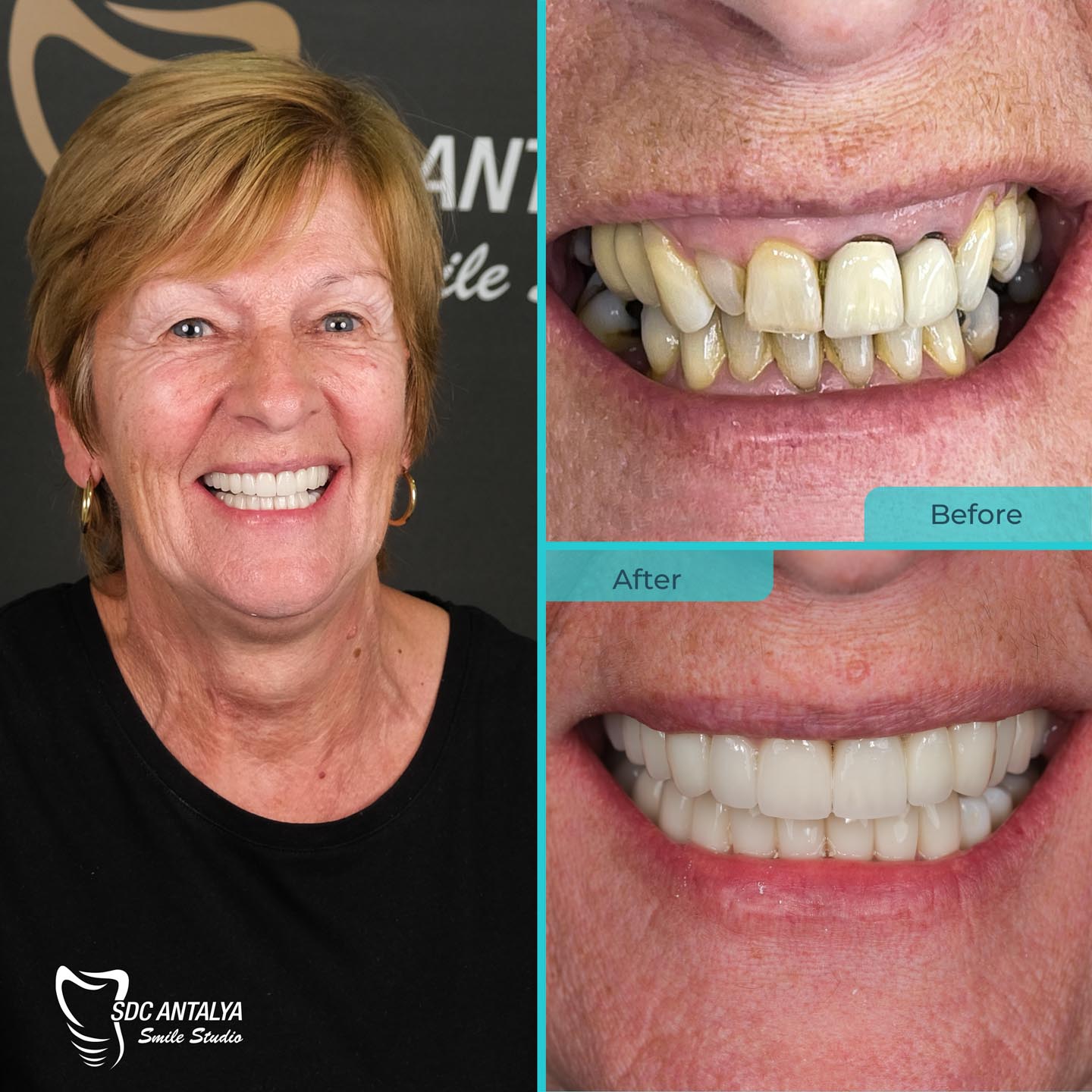 Sdc Antalya Smile Studio