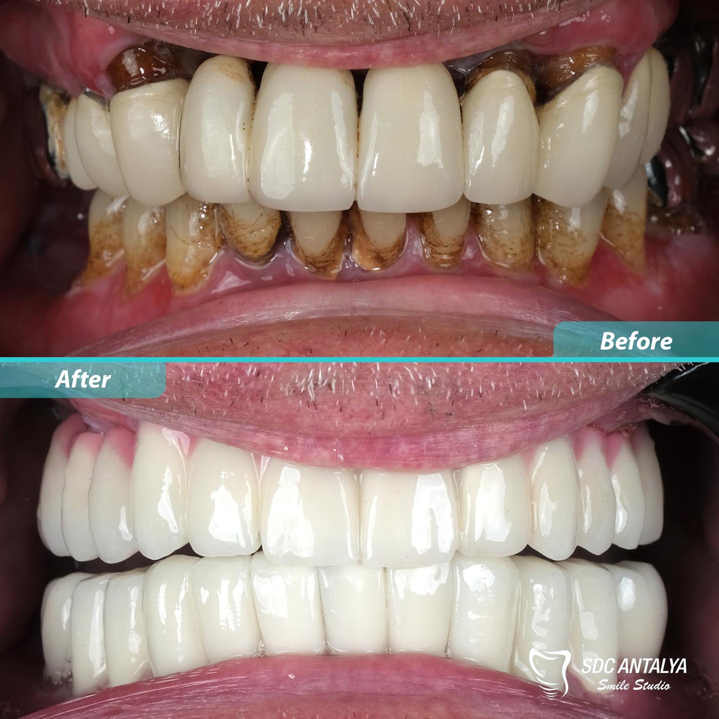 Sdc Antalya Smile Studio