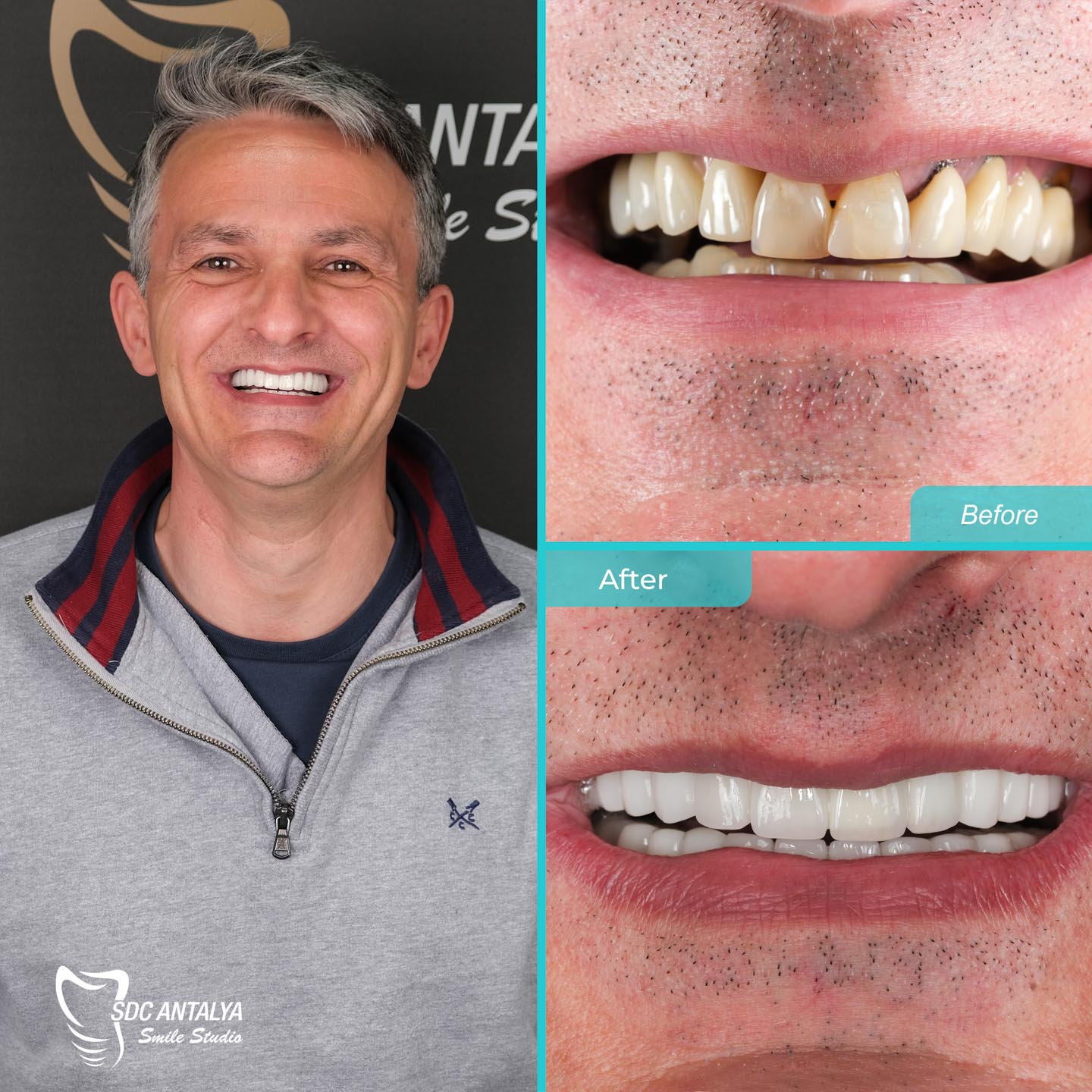 Sdc Antalya Smile Studio