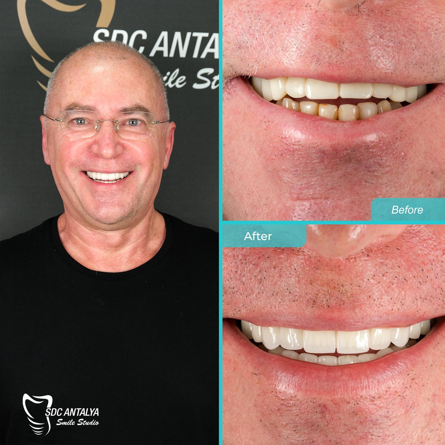 Sdc Antalya Smile Studio