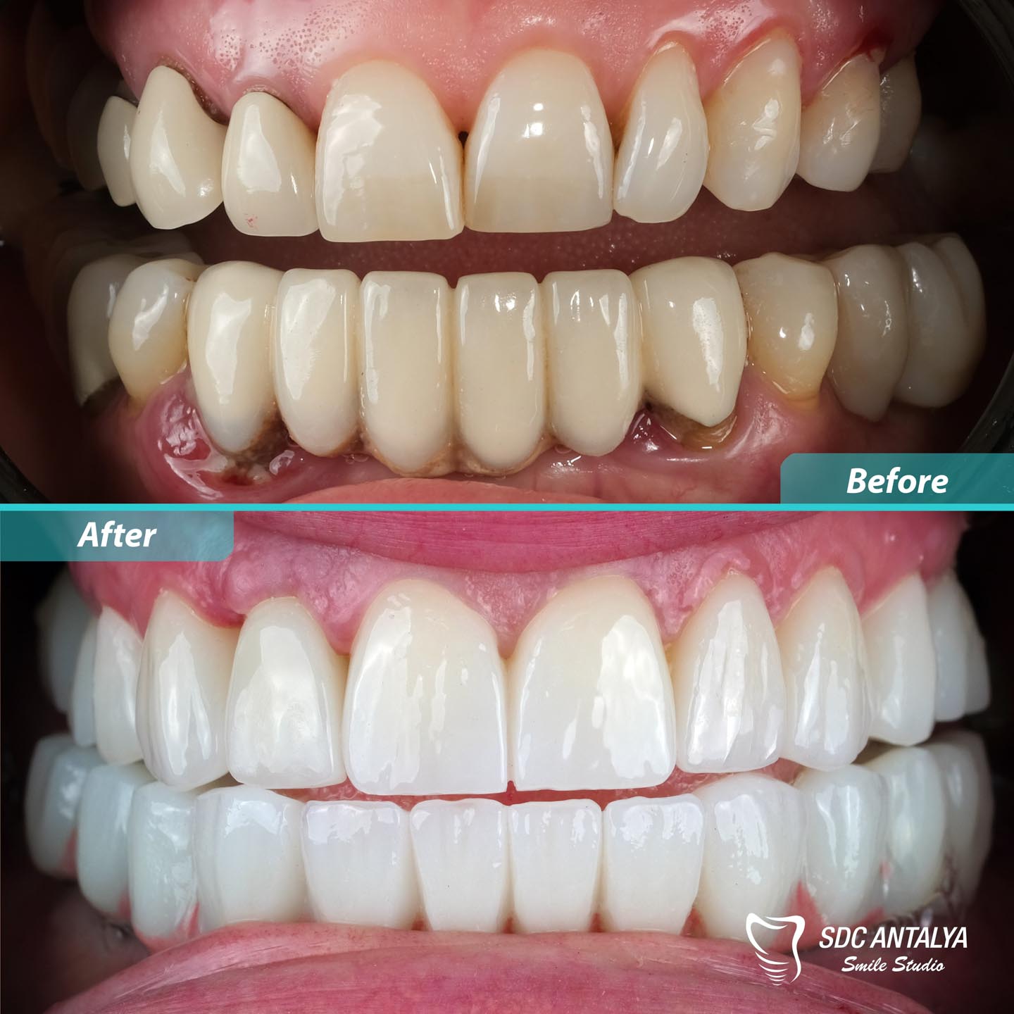 Sdc Antalya Smile Studio