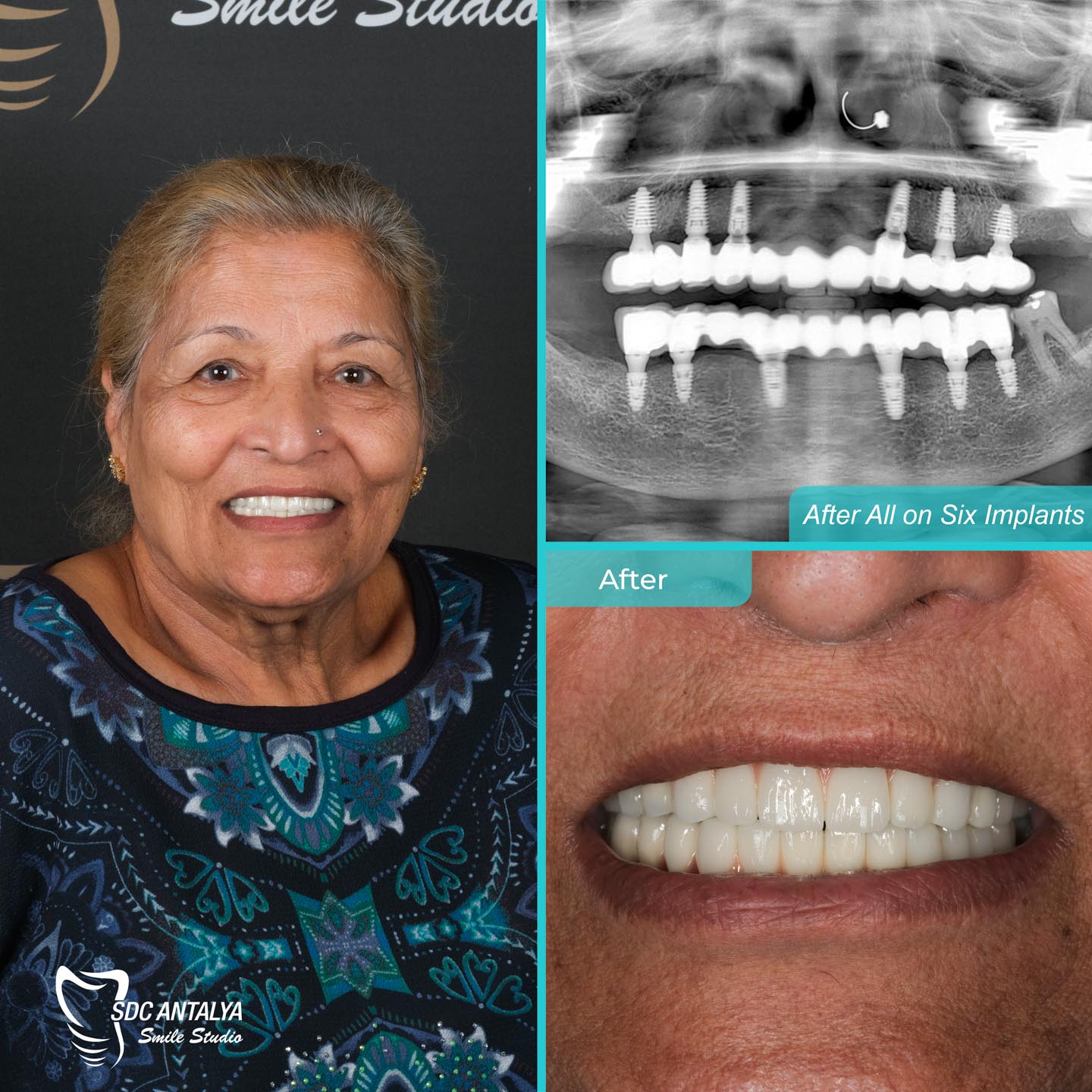 Sdc Antalya Smile Studio