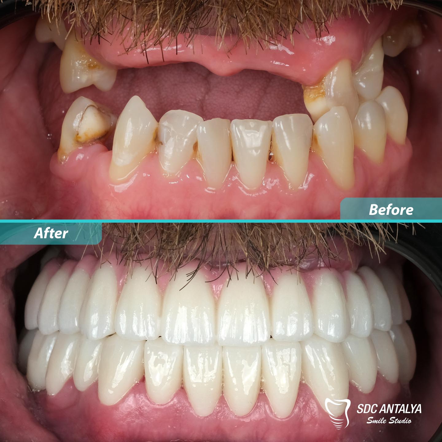 Sdc Antalya Smile Studio