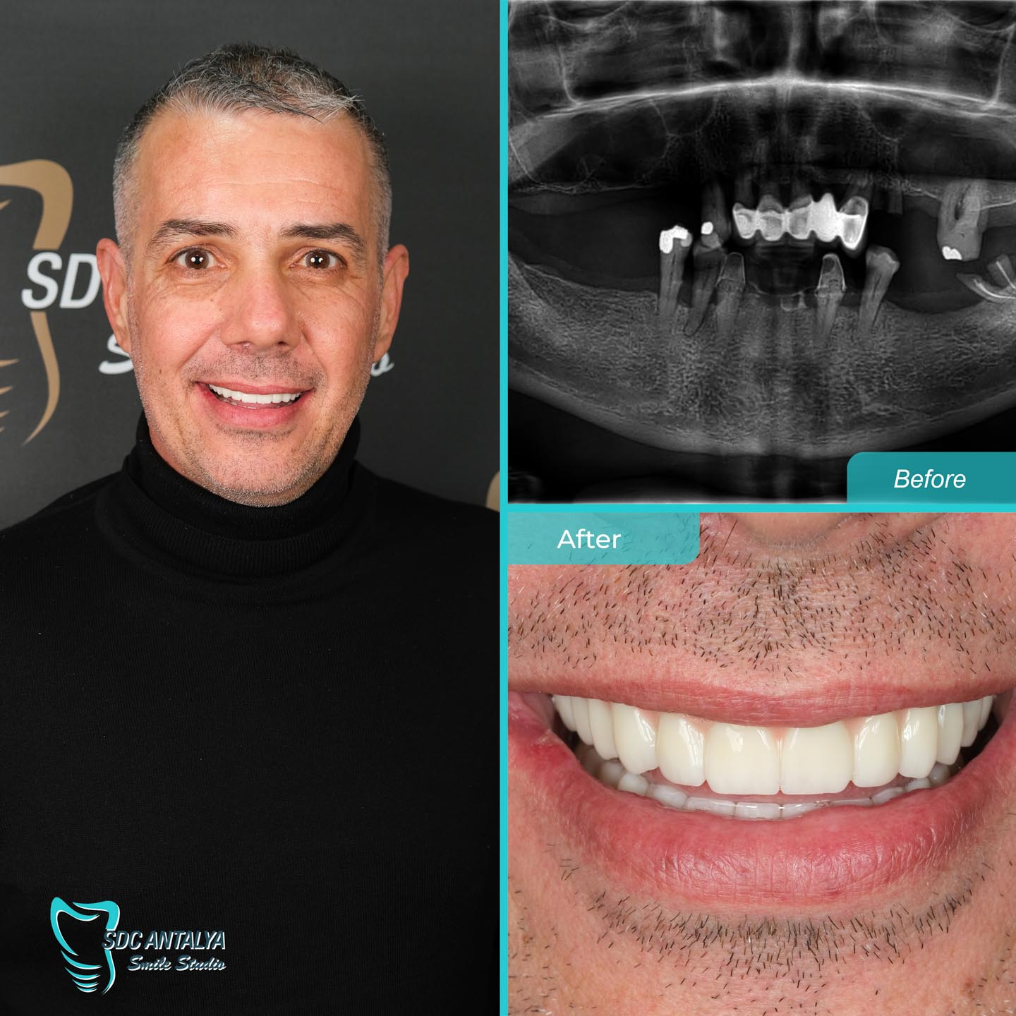 Sdc Antalya Smile Studio