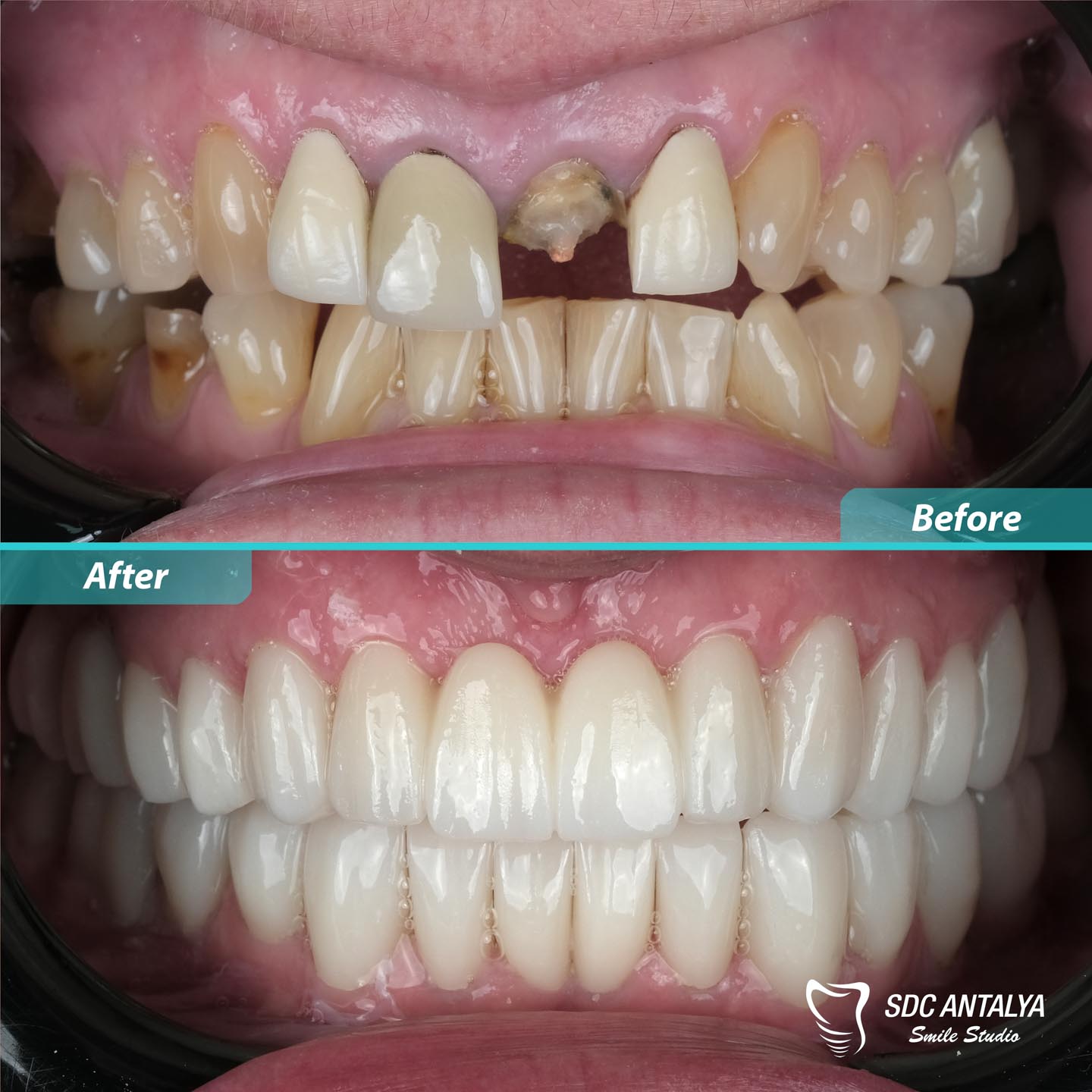 Sdc Antalya Smile Studio