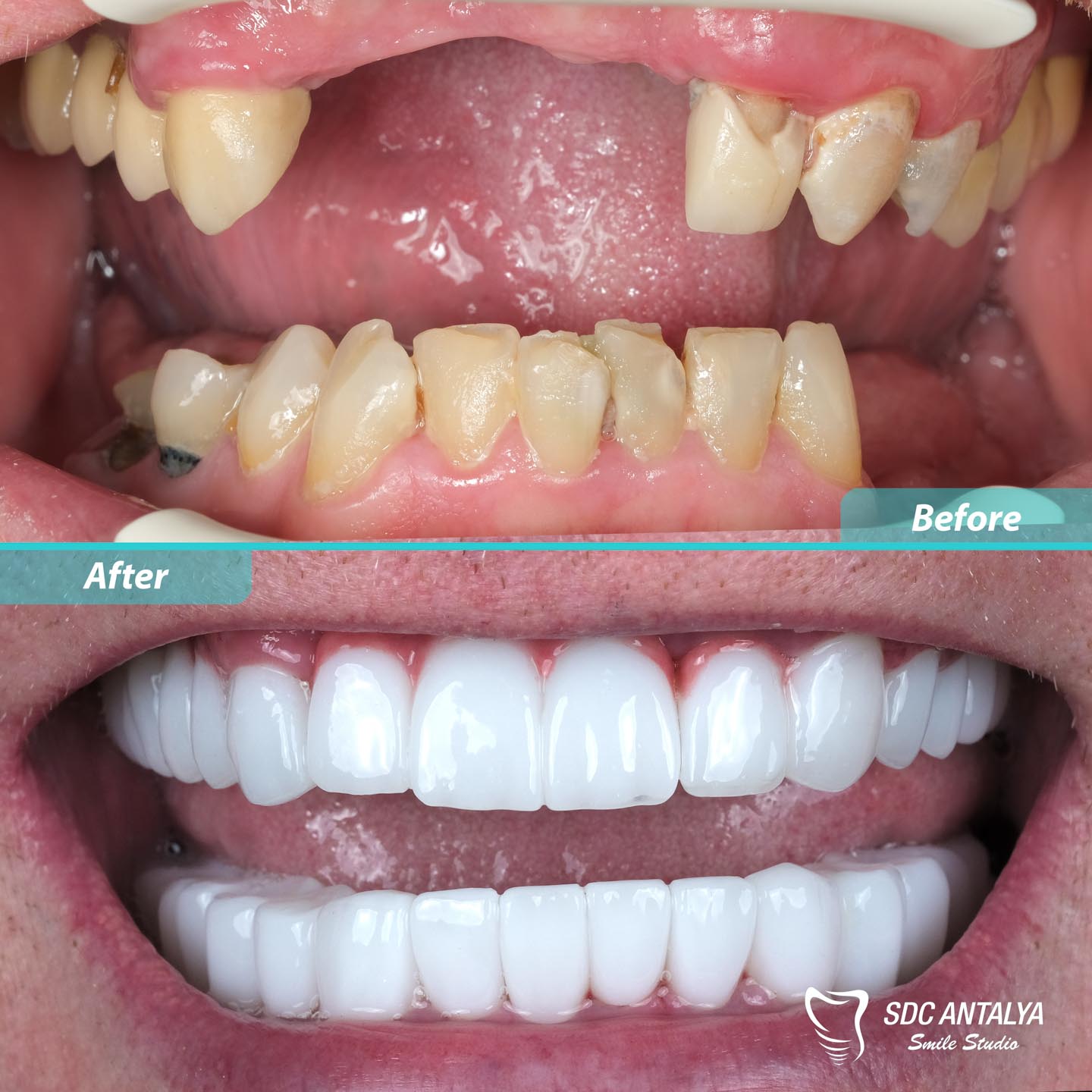 Sdc Antalya Smile Studio