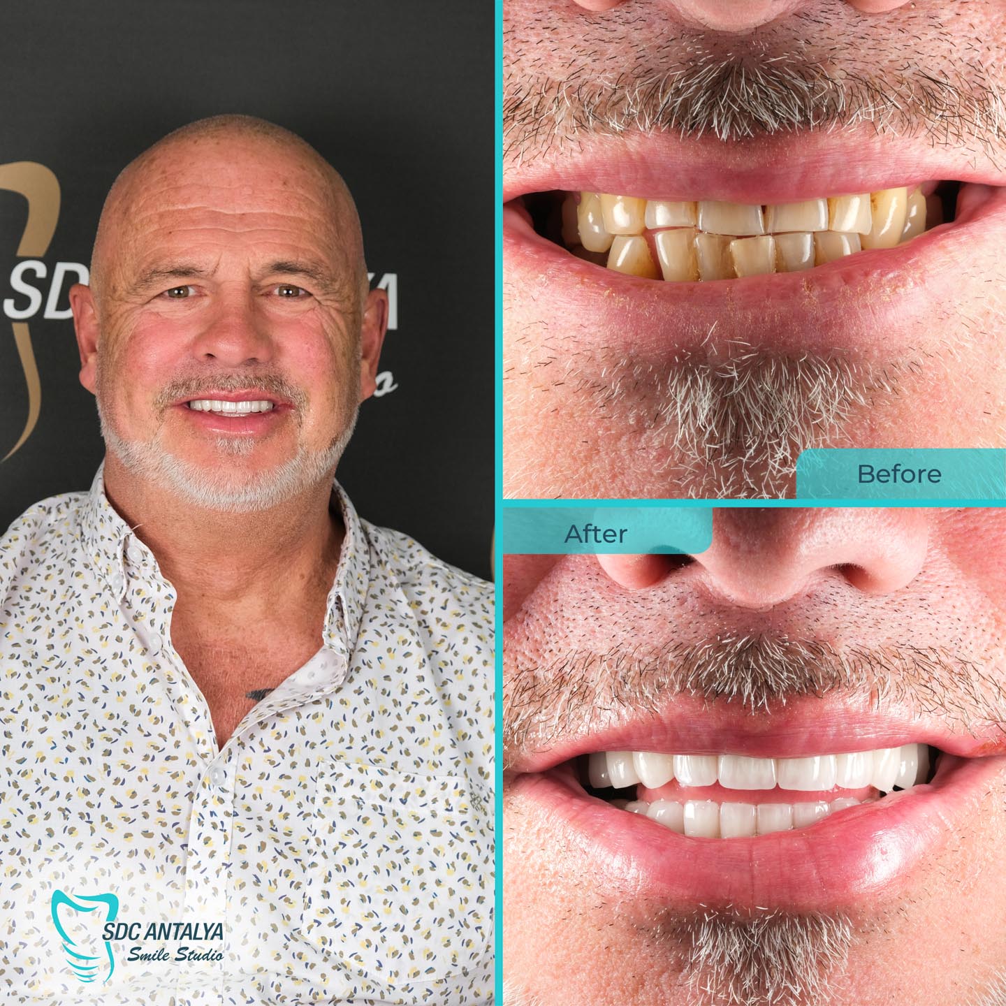 Sdc Antalya Smile Studio