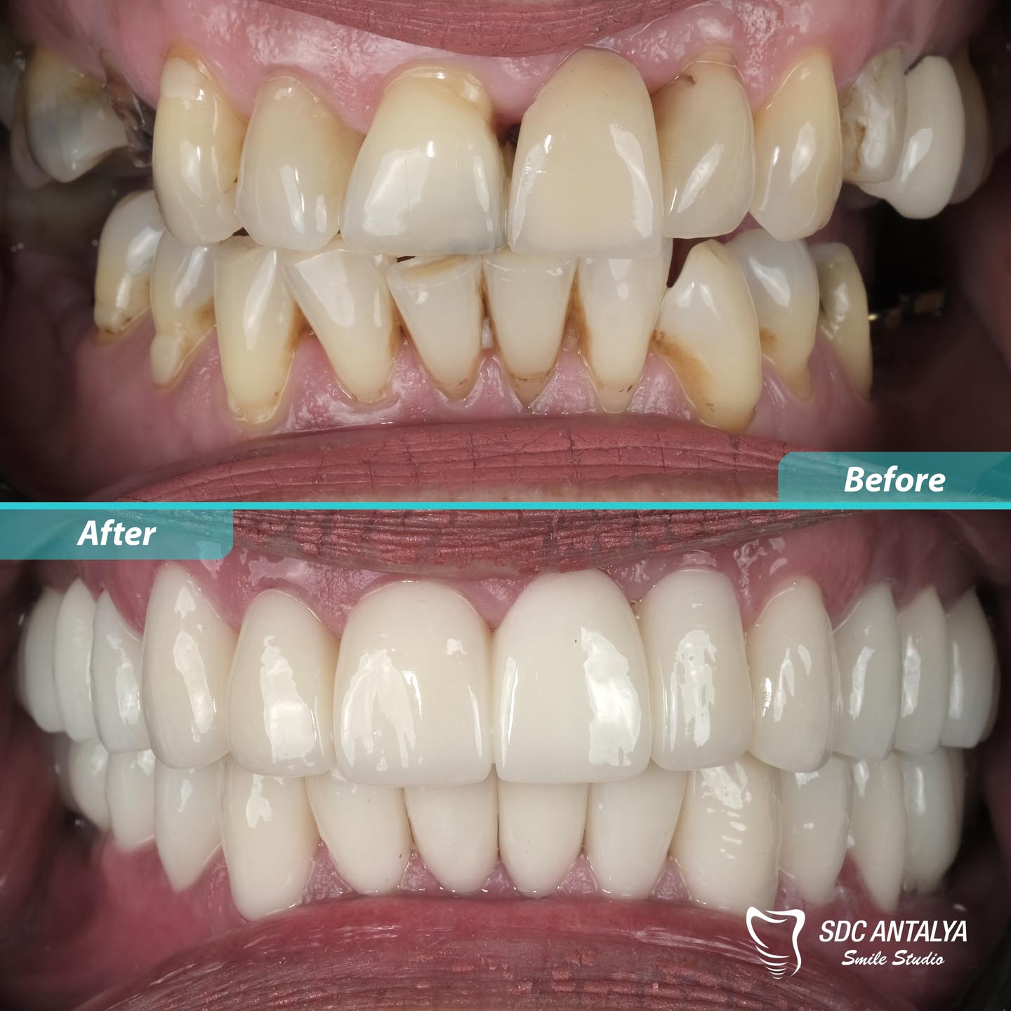 Sdc Antalya Smile Studio