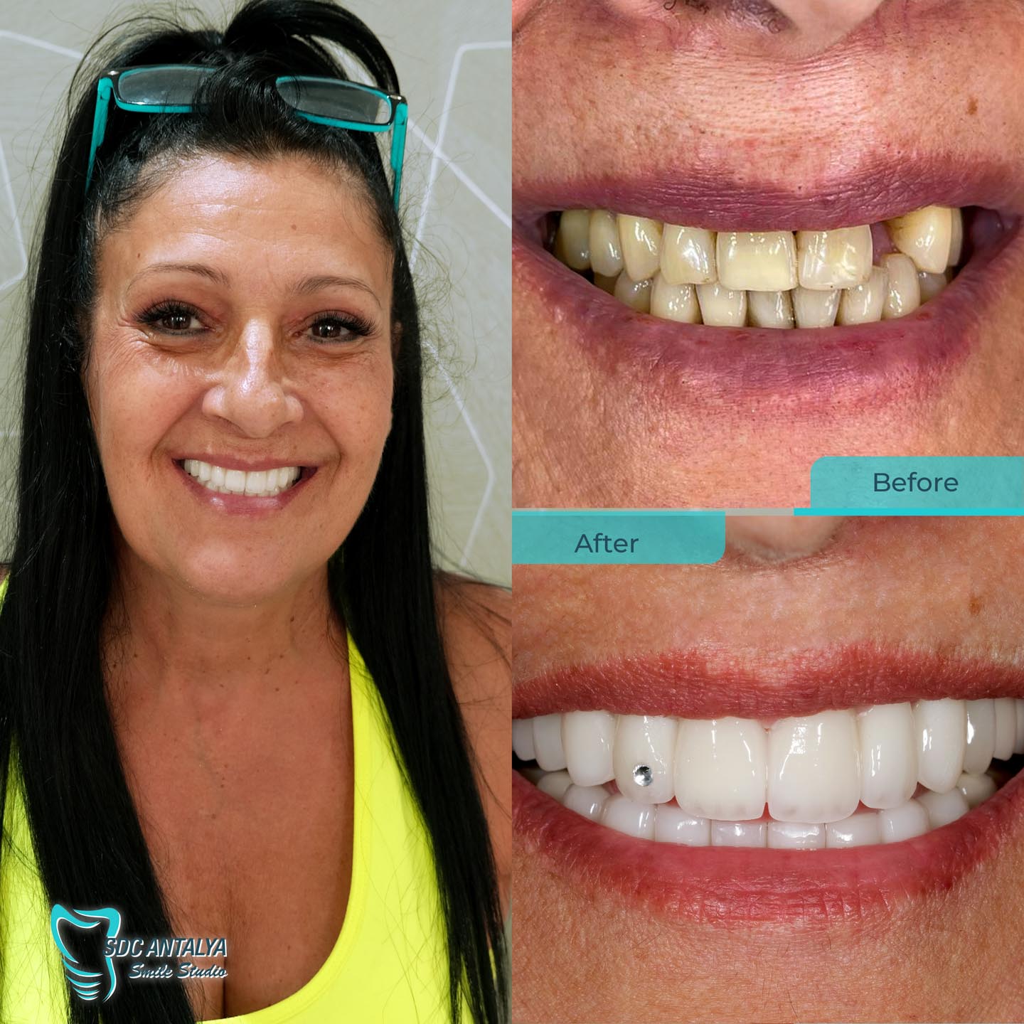 Sdc Antalya Smile Studio