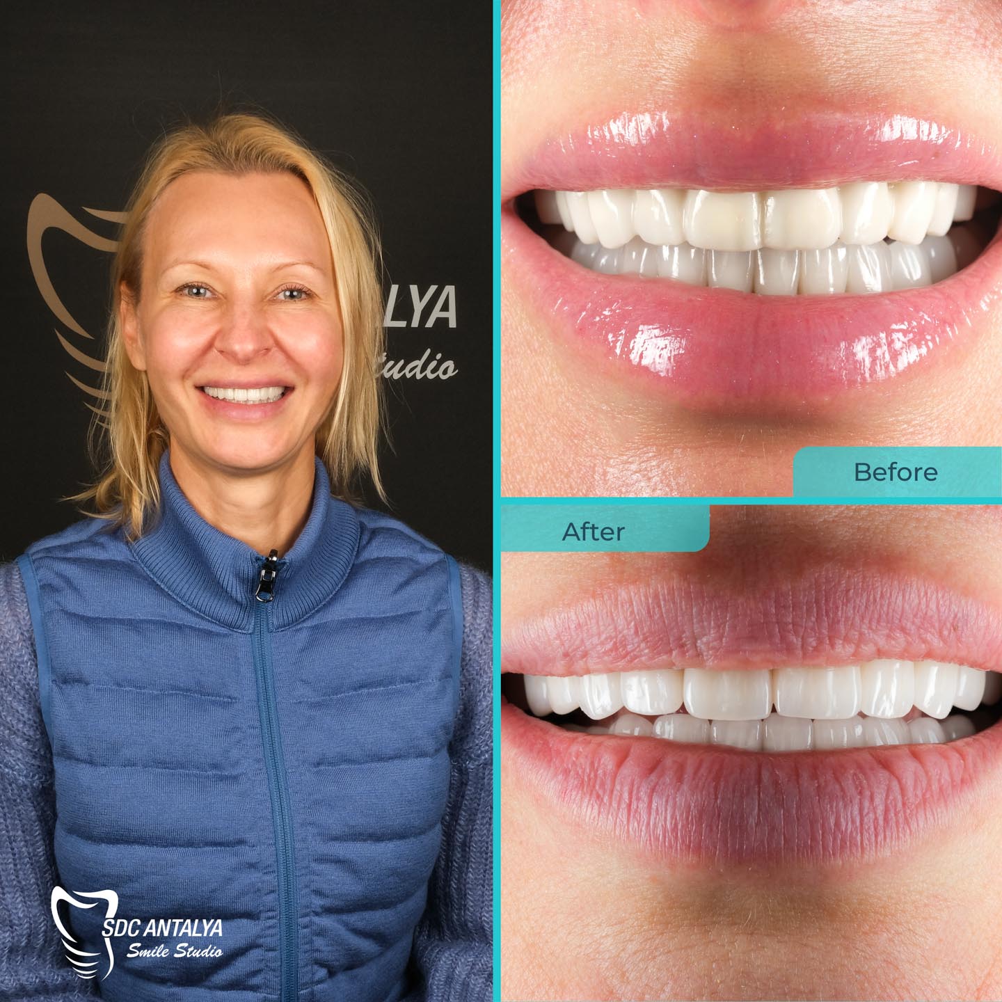 Sdc Antalya Smile Studio