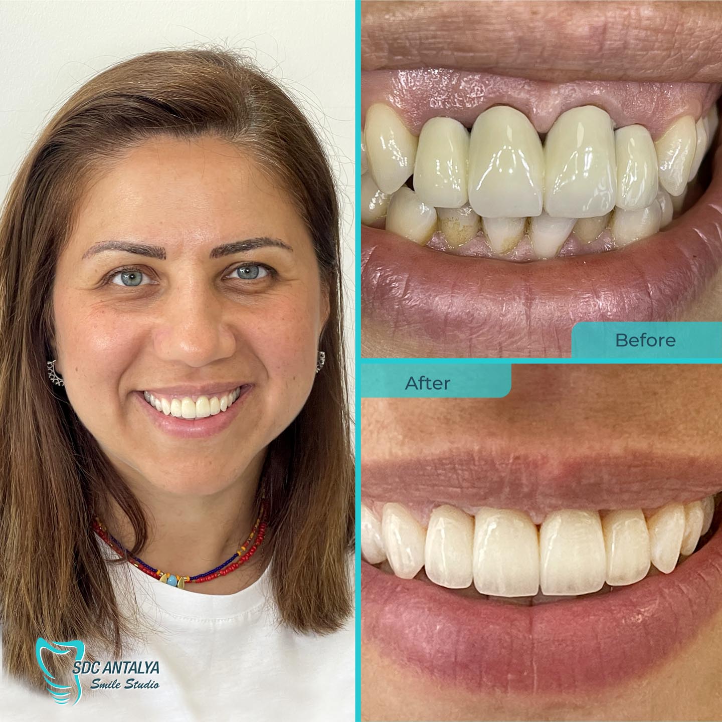 Sdc Antalya Smile Studio