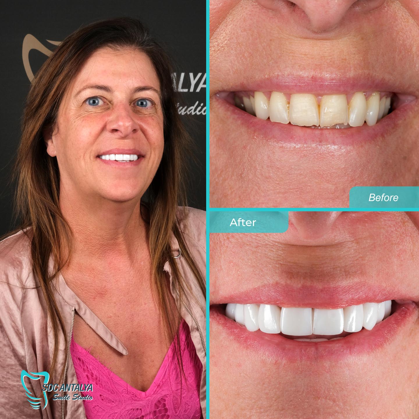 Sdc Antalya Smile Studio