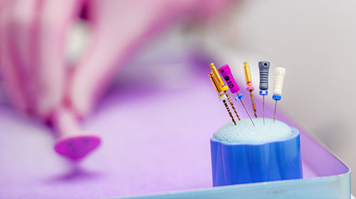 Root Canal Treatments (Endodontics)