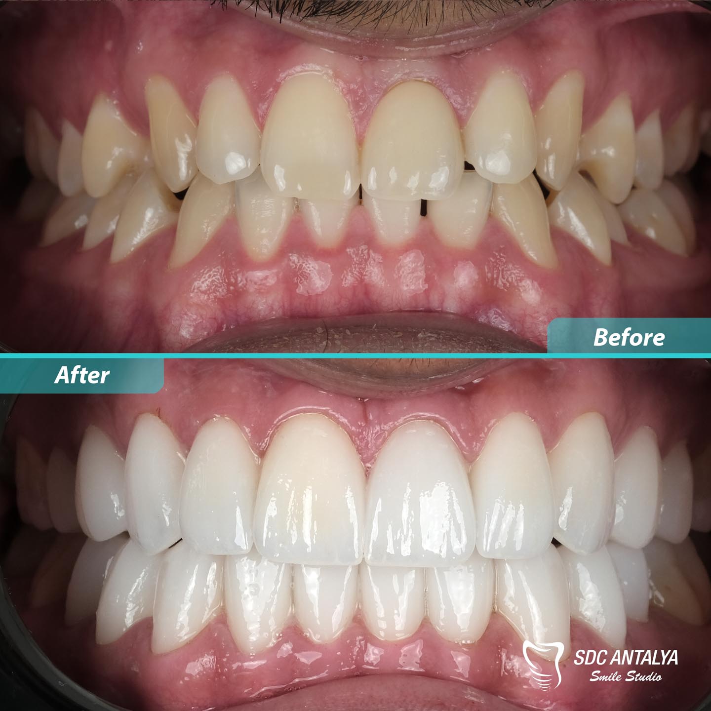 Sdc Antalya Smile Studio