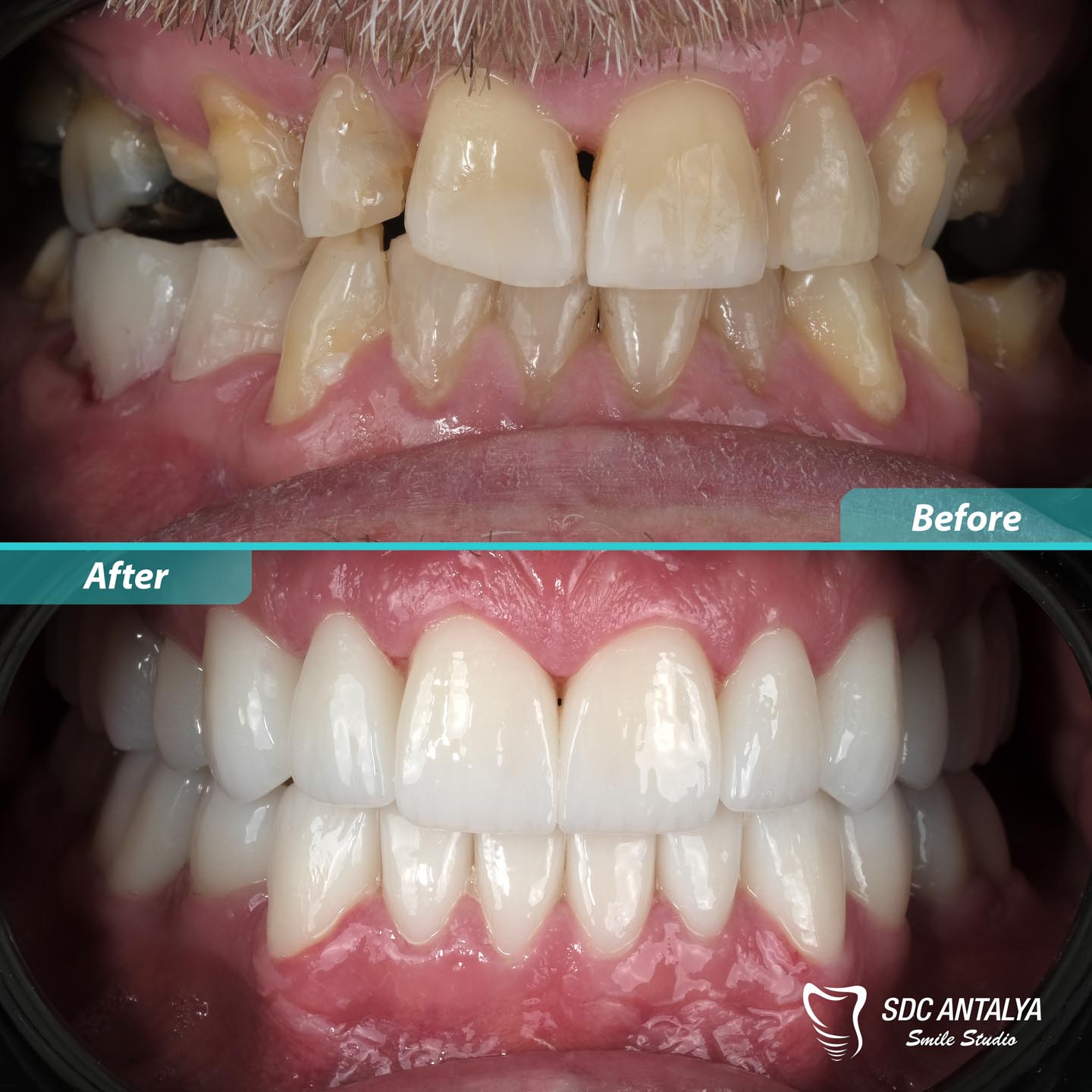 Sdc Antalya Smile Studio