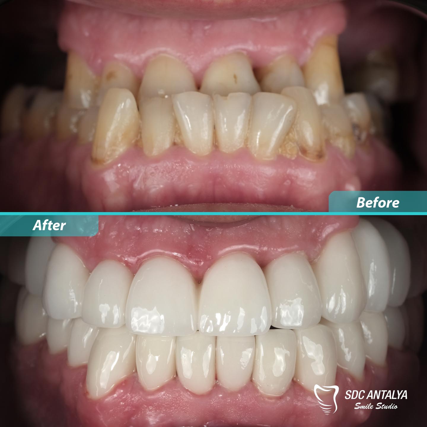 Sdc Antalya Smile Studio