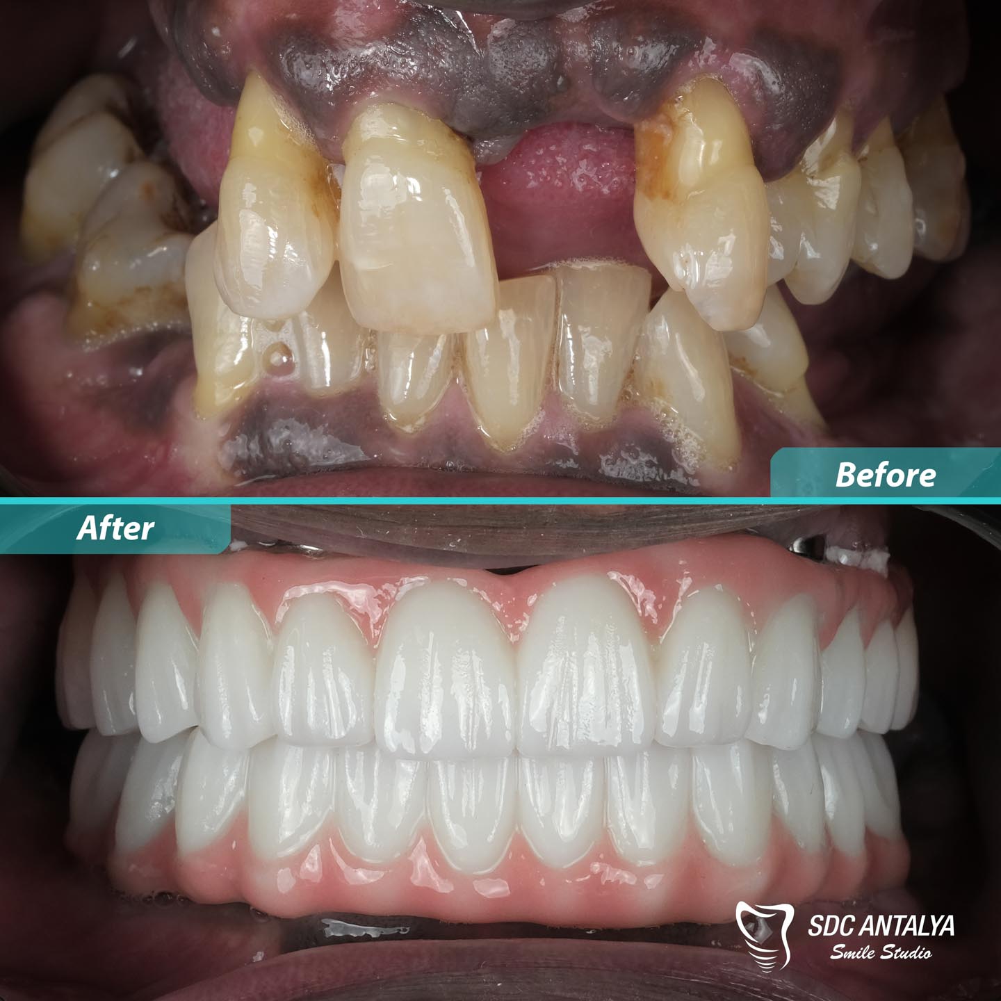 Sdc Antalya Smile Studio
