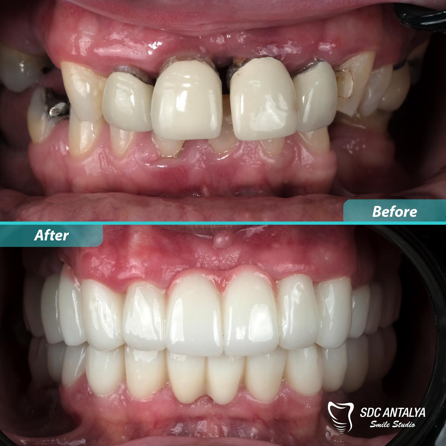 Sdc Antalya Smile Studio
