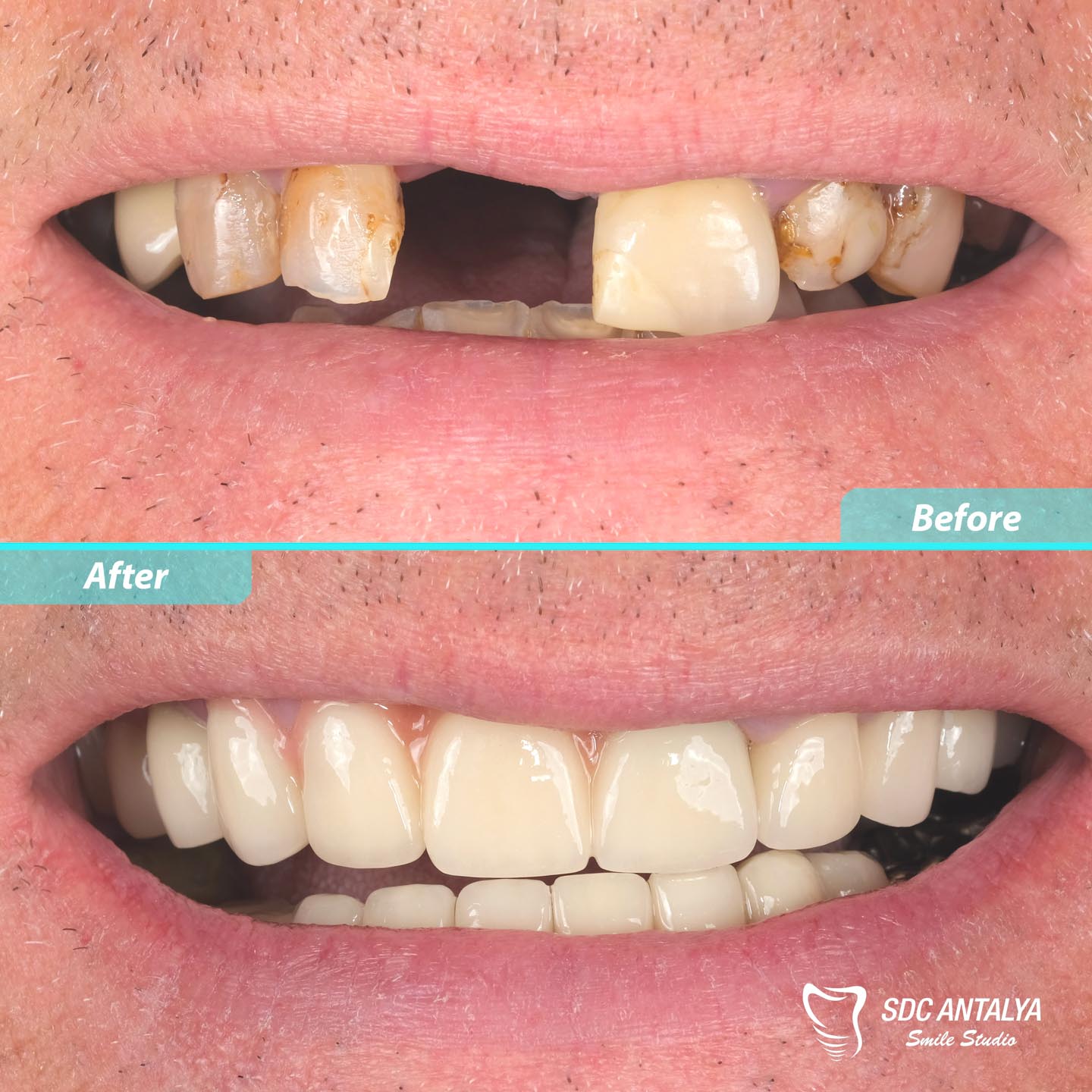 Sdc Antalya Smile Studio
