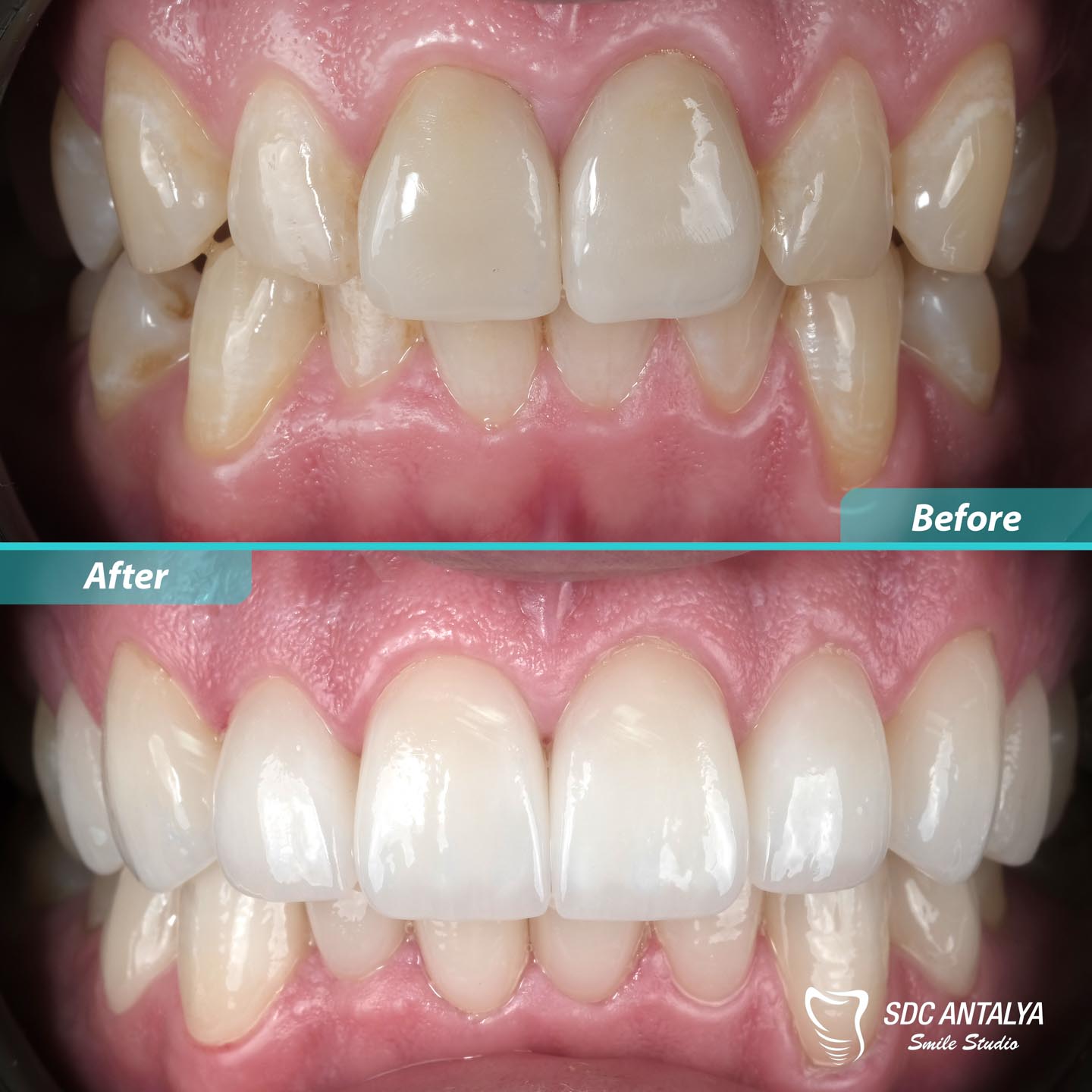 Sdc Antalya Smile Studio