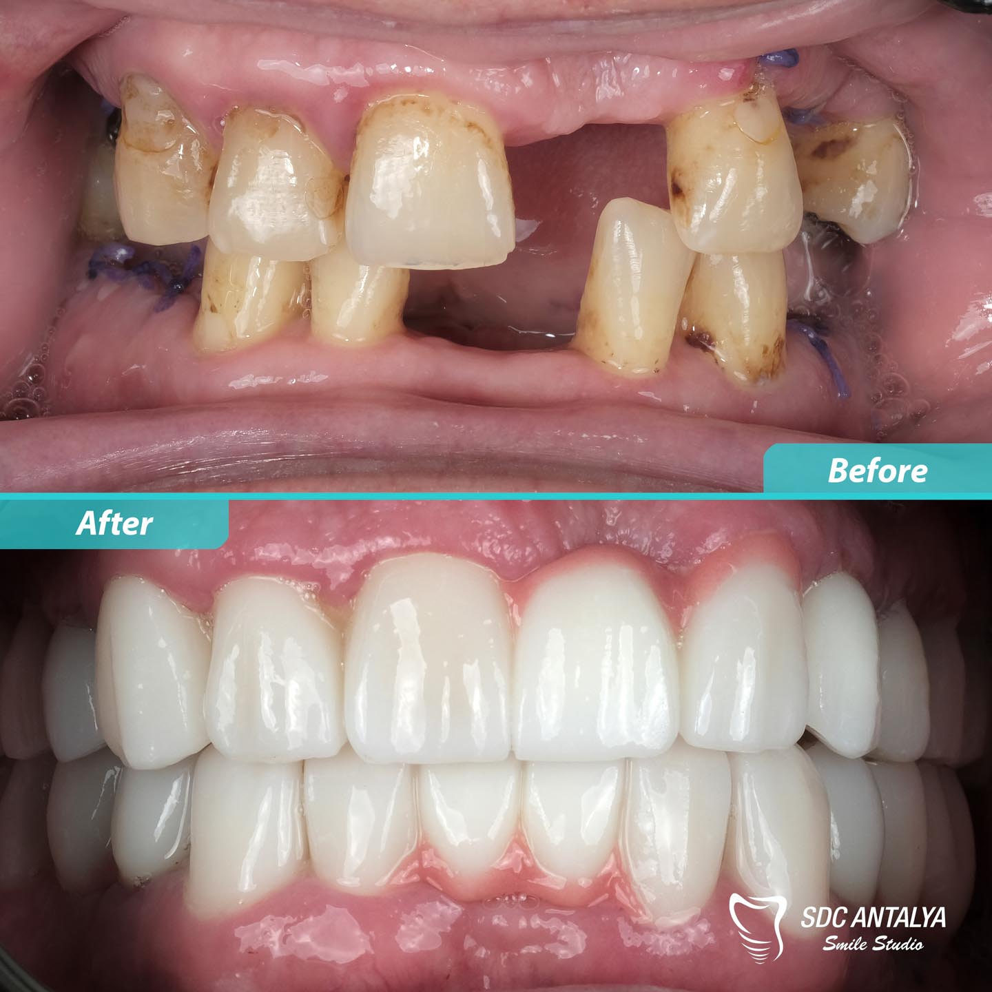 Sdc Antalya Smile Studio