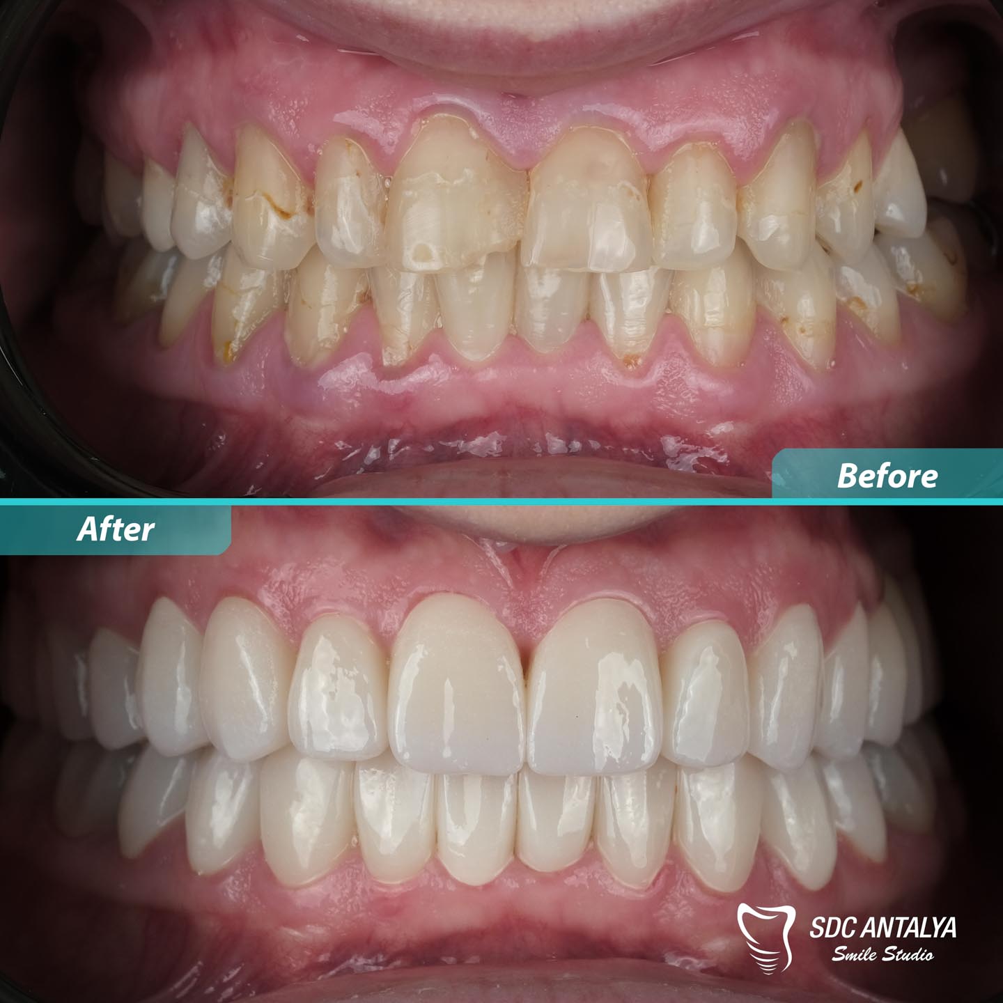 Sdc Antalya Smile Studio