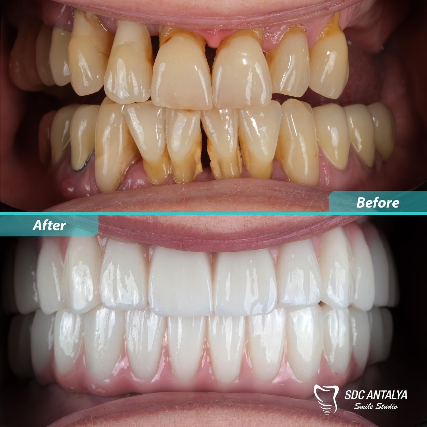 Sdc Antalya Smile Studio