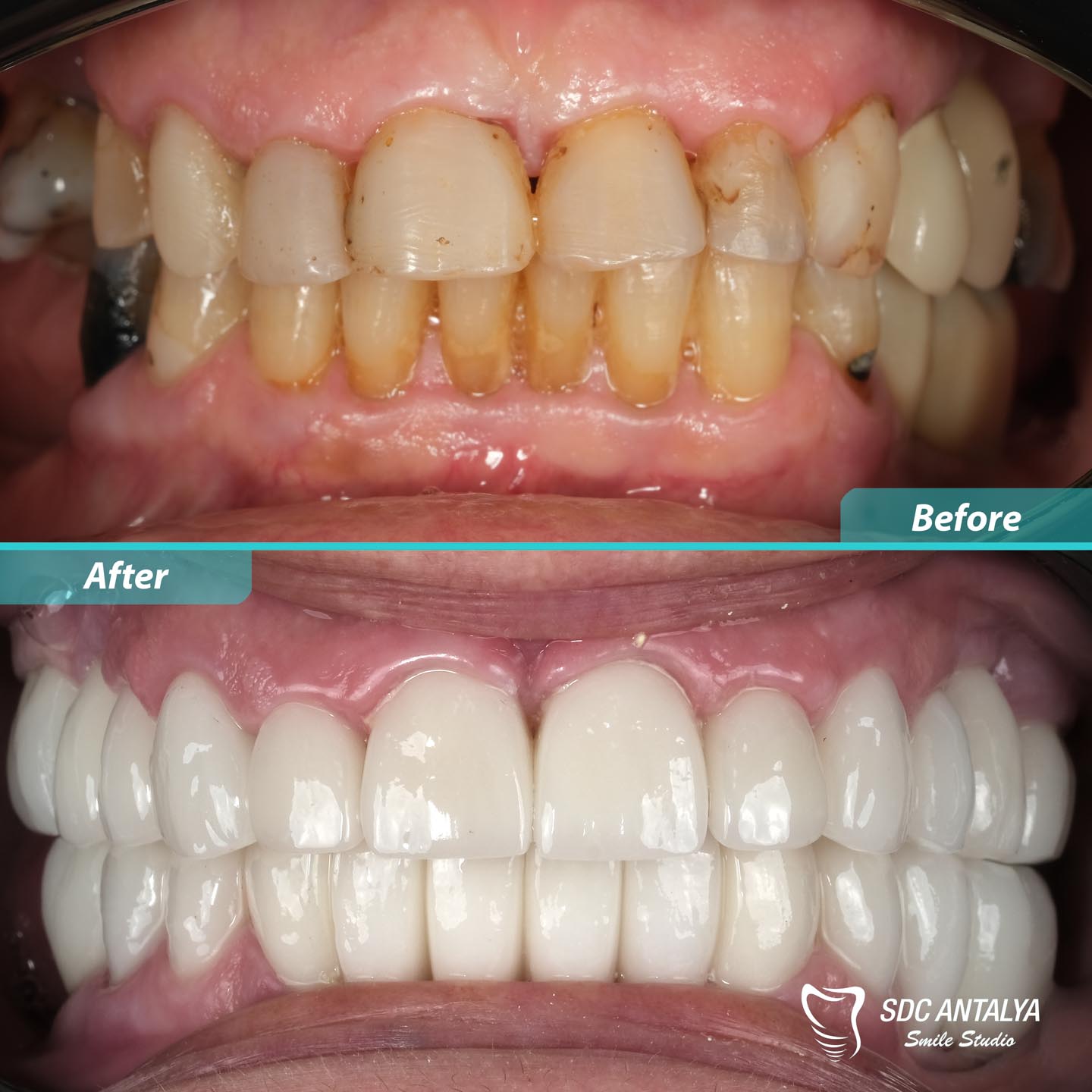 Sdc Antalya Smile Studio