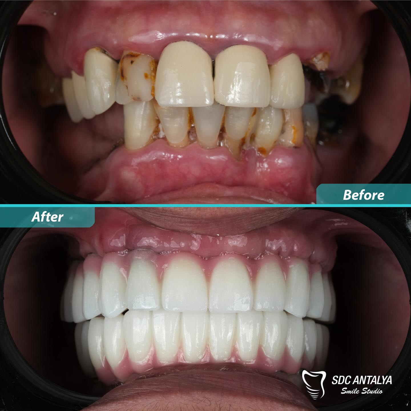 Sdc Antalya Smile Studio