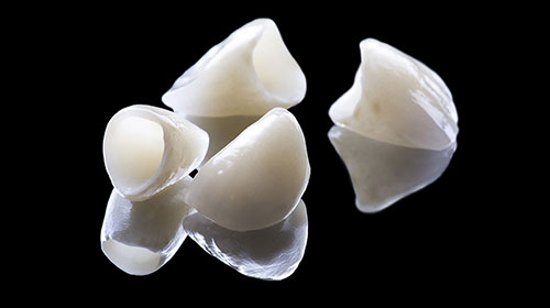 Zirconium Crowns