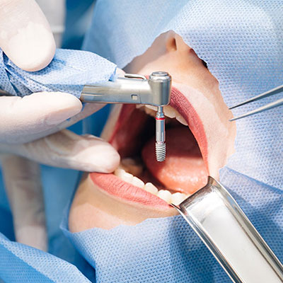 Oral, Dental and Maxillofacial Surgery Treatments